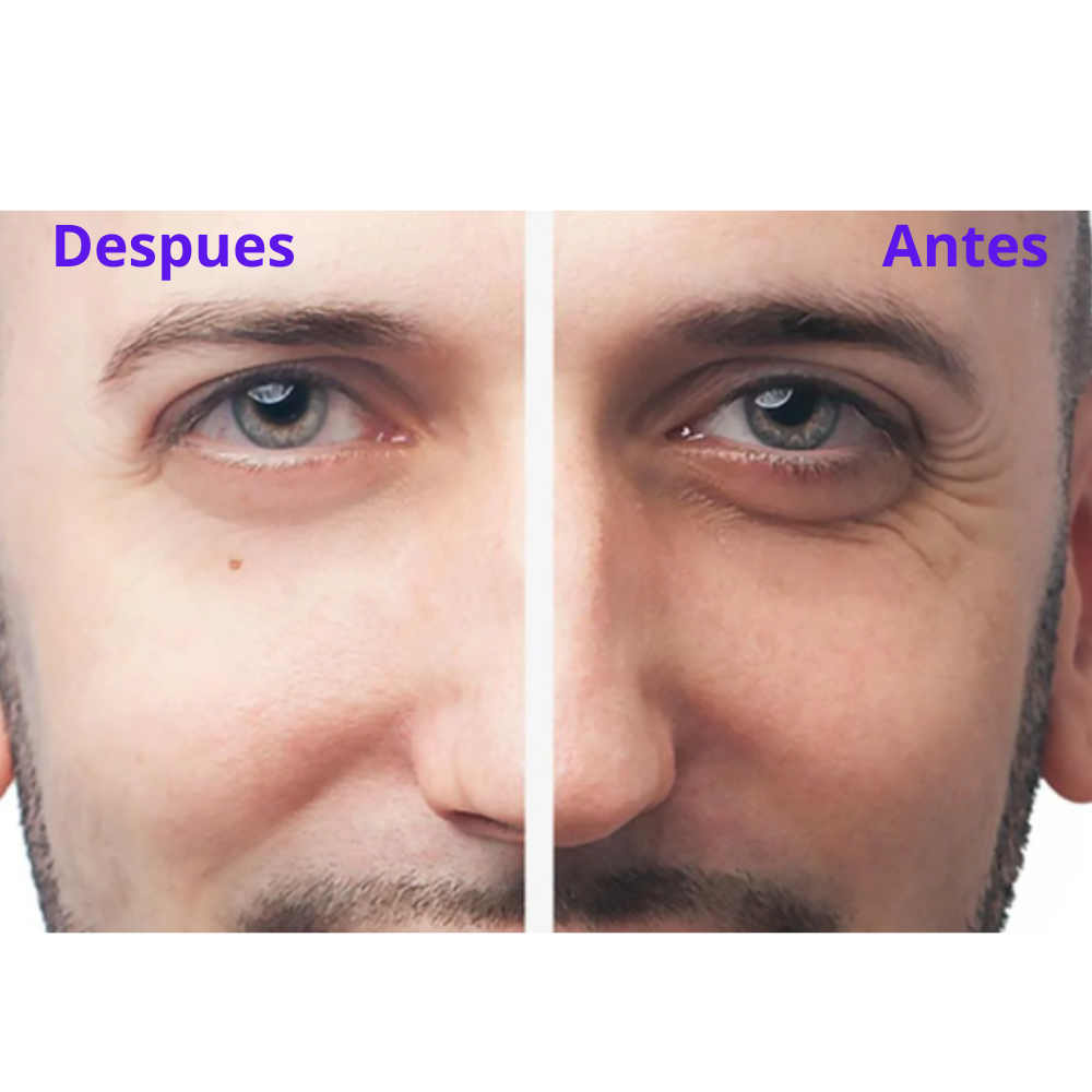 “Despídete de bolsas y ojeras en 2–4 semanas, sin tratamientos caros ni agujas”